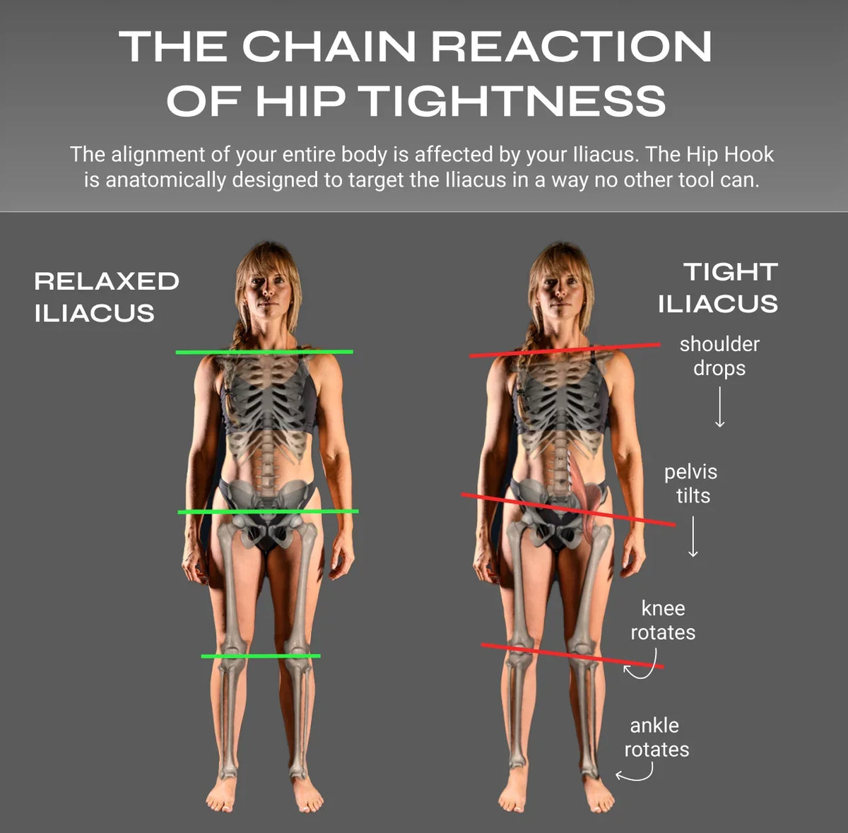 Hip Hook Deep Muscle Release Tool